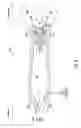 Fig. 10 - Temperature sensor assembly for swirling flows
