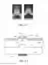 Fig. 08 - Active-source-pixel, integrated device for rapid analysis of biological and chemical specimens