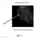 Fig. 04 - Apparatus and methods for endometrial tissue identification