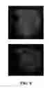 Fig. 09 - Apparatus and methods for endometrial tissue identification