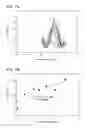 Fig. 10 - Quantification of inflammatory molecules in exhaled breath condensate using differential pulse voltammetry on reduced graphene oxide sensor
