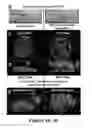 Fig. 08 - Methods and apparatus for modeling cancer metastasis in vitro