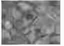 Fig. 01 - Method for predicting effect of drug