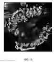Fig. 06 - Methods of predicting progression of Barrett's esophagus