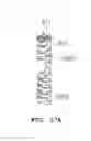 Fig. 24 - Contact and test socket device for testing semiconductor device