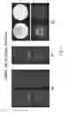 Fig. 03 - FAST METHOD FOR DETERMINING THE POSITION OF A FERROMAGNETIC PARTICLE OR A BUNCH OF FERROMAGNETIC PARTICLES USING MRI SYSTEMS