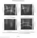 Fig. 11 - System and method for enabling radar operation in a spectrally congested environment