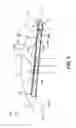 Fig. 04 - SYSTEMS, DEVICES, AND METHODS EMPLOYING WAVEGUIDES EMBEDDED IN CURVED LENSES