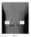 Fig. 04 - System and method to collect gesture input through wrist tendon and muscle sensing