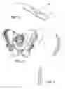 Fig. 07 - PERSONALIZED FIT AND FUNCTIONAL DESIGNED MEDICAL PROSTHESES AND SURGICAL INSTRUMENTS AND METHODS FOR MAKING
