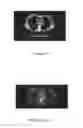 Fig. 01 - Computed tomography image processing and data analysis
