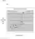 Fig. 06 - Automated method for tissue-based contrast media arrival detection for dynamic contrast enhanced MRI