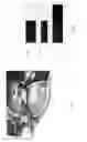 Fig. 05 - Systems and methods for determining three dimensional measurements in telemedicine application
