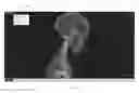Fig. 01 - Method for segmentation of the head-neck arteries, brain and skull in medical images