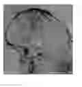 Fig. 01 - Analysis method and system of digital subtraction angiographic images