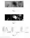 Fig. 06 - Analysis method and system of digital subtraction angiographic images