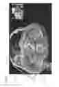 Fig. 04 - In-context photorealistic 3D visualization for surgical decision support