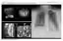 Fig. 01 - Method and system for rule-based display of sets of images