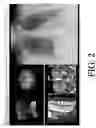 Fig. 03 - Method and system for rule-based display of sets of images