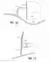Fig. 09 - Accessible radome assembly