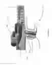 Fig. 06 - Integrated protector for a connector