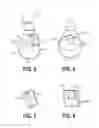 Fig. 04 - CAPACITIVE POWER TRANSFER ARRANGEMENT