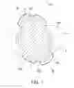 Fig. 02 - Acoustic resonator and method for manufacturing the same