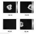 Fig. 37 - Methods and Systems for Light Field Compression Using Multiple Reference Depth Image-Based Rendering