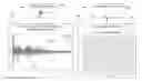 Fig. 01 - System and method for multiplexed ultrasound hearing