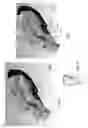 Fig. 02 - Antenna unit