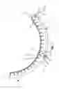 Fig. 07 - Combine harvester concave assembly and attachment method