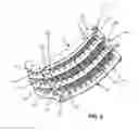 Fig. 08 - Combine harvester concave assembly and attachment method
