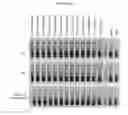 Fig. 03 - Reduction of erythrocyte sedimentation rate