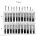Fig. 04 - Reduction of erythrocyte sedimentation rate