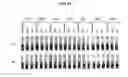 Fig. 05 - Reduction of erythrocyte sedimentation rate