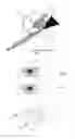 Fig. 02 - Method for manufacturing inductively heatable tobacco rods