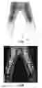 Fig. 08 - Laser finishing of apparel
