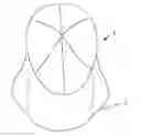 Fig. 01 - REMOVABLE CHIN STRAP FOR A HAT'S BRIM