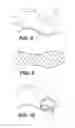 Fig. 08 - Pre-tensioned article and method of making