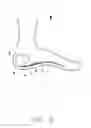Fig. 03 - Device to mitigate heel pain