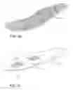 Fig. 07 - Surgical shoe for receiving an orthotic insert