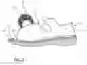 Fig. 08 - Surgical shoe for receiving an orthotic insert