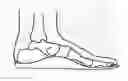 Fig. 01 - SHOES WITH ORTHOTIC ARCH SUPPORT