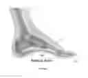Fig. 02 - SHOES WITH ORTHOTIC ARCH SUPPORT