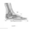Fig. 03 - SHOES WITH ORTHOTIC ARCH SUPPORT