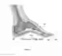 Fig. 04 - SHOES WITH ORTHOTIC ARCH SUPPORT