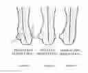 Fig. 05 - SHOES WITH ORTHOTIC ARCH SUPPORT