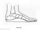 Fig. 12 - SHOES WITH ORTHOTIC ARCH SUPPORT