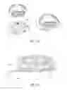 Fig. 48 - Integrated closure device components and methods