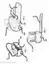 Fig. 04 - Sleeping backpack trolley bag